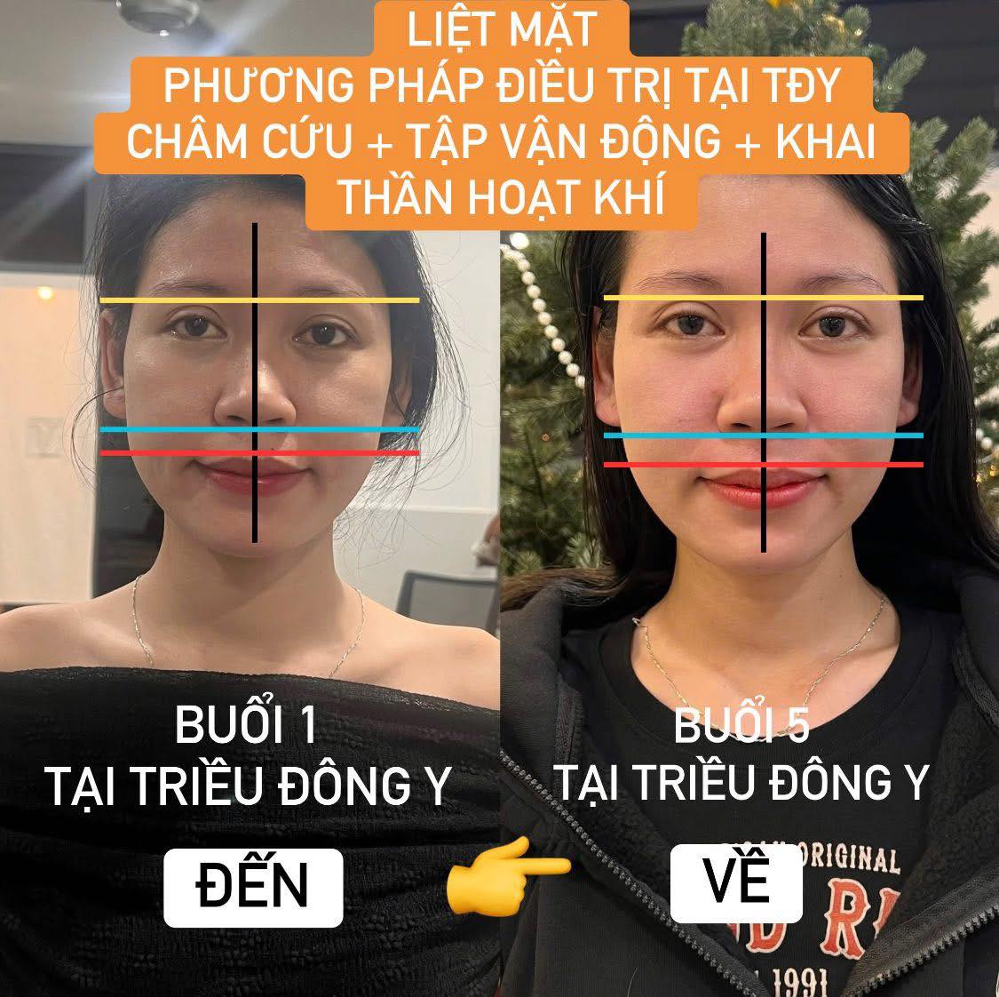 Khám liệt dây thần kinh số 7 ở đâu Quận 7? Xem ngay 9 bác sĩ "mát tay" chuyên Phục hồi chức năng, điều trị dứt điểm liệt Bell an toàn, hiệu quả